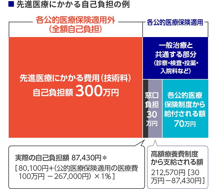 先進医療にかかる自己負担の例