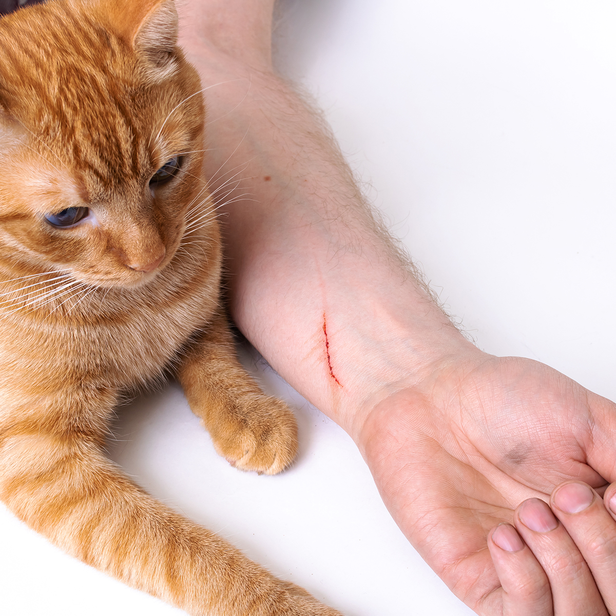 Scratch Fever My Cat Scratched Me Should I Be Worried Top Cat